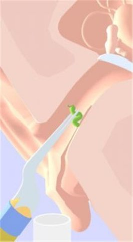 挖耳朵模拟器游戏